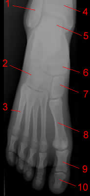 Foot X-ray-AP projection