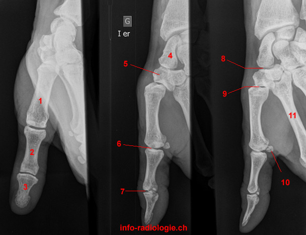 Radiograph of the thumb (3 images)