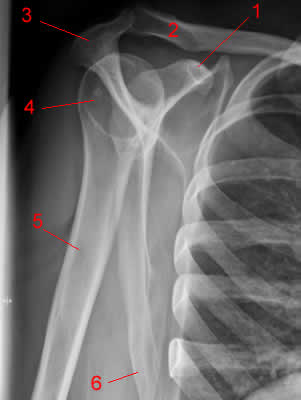 Radiographie de l'épaule: cliché de profil